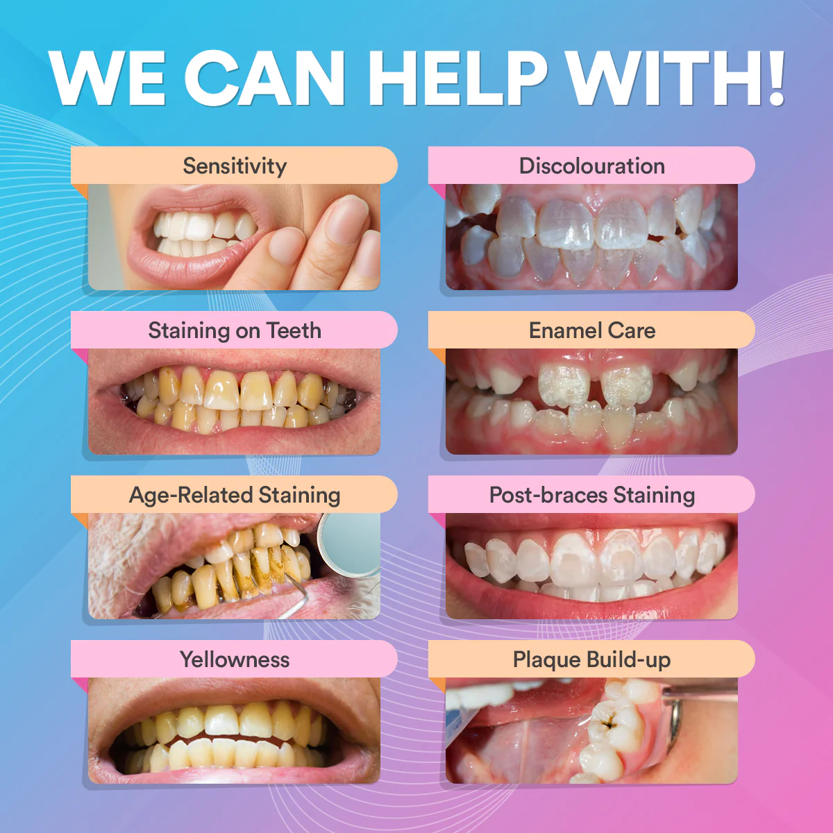 Advanced PAP+ Teeth Whitening Kit - Image 10