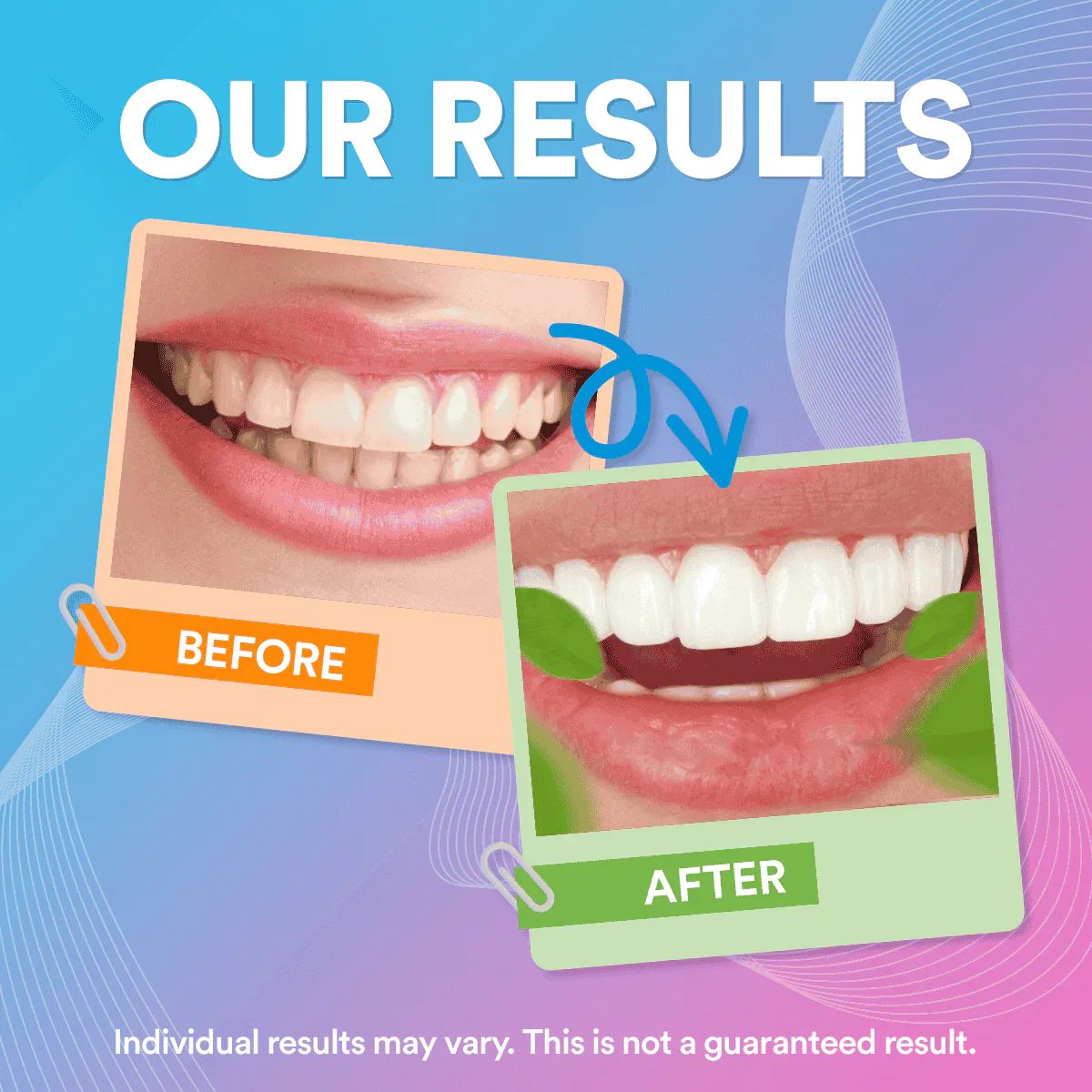 Flavoured Toothpaste DP5 - Image 12