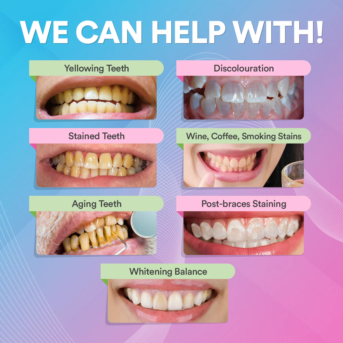PAP+ Pro Teeth Whitening Powder DP11 - Image 9