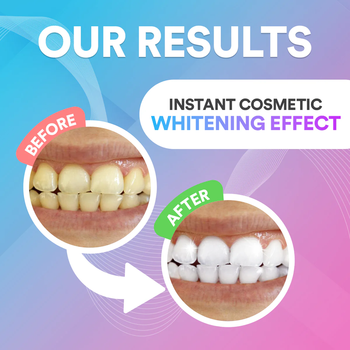 Teeth Whitening Pen - Image 6